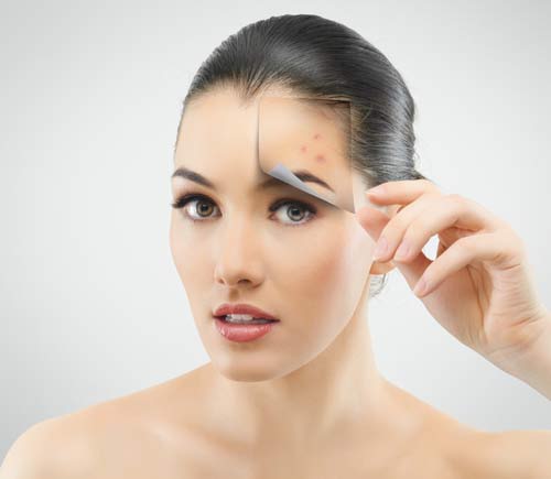 Chìa khóa trị sẹo lõm từ thiên nhiên - 2