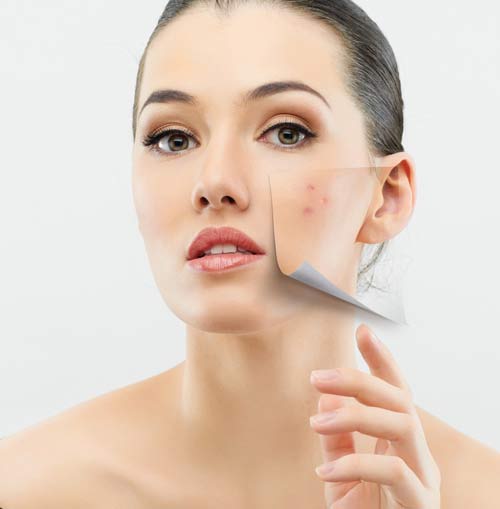Chìa khóa trị sẹo lõm từ thiên nhiên - 3
